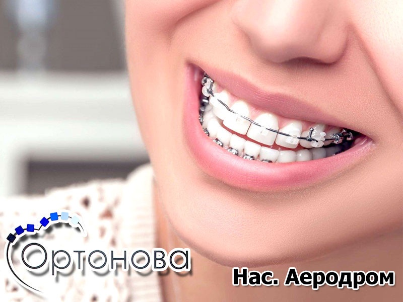 Специјалистички ортодонтски преглед + 30% дополнителен попуст