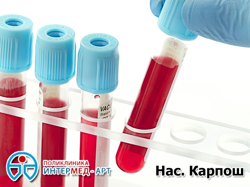 Комплет лабораториски услуги (крвна слика со седиментација + урина)