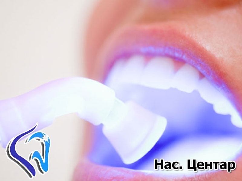 Ласерско белеење на заби (два третмани) + полирање 