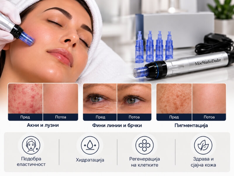 Dermapen третман на лице во „Мое Студио Дадар“