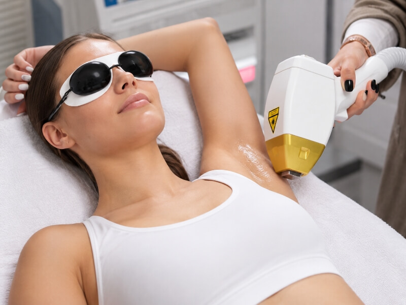 Ласерска Епилација на пазуви во Центар за естетика и козметологија „Beauty room S“